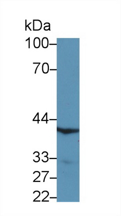 13874