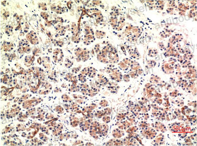 Валидация AntibodySystem RHE14403