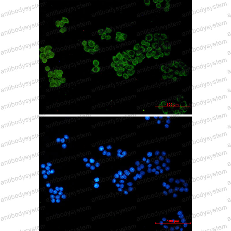 Валидация IF - AntibodySystem RHD32602
