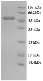 SDS-PAGE