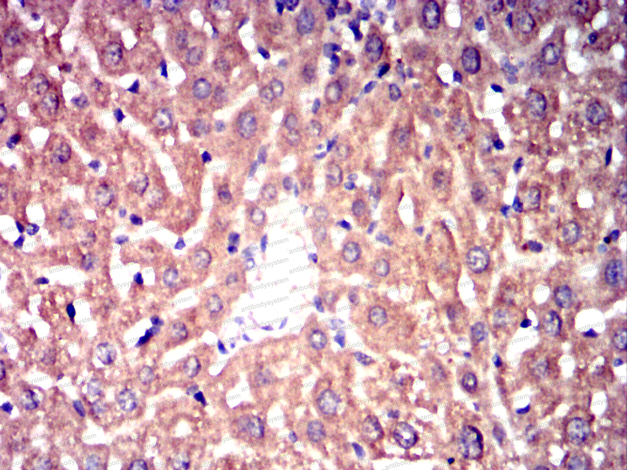 Валидация AntibodySystem RHD38803 (1551)