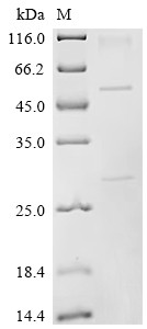 SDS-PAGE