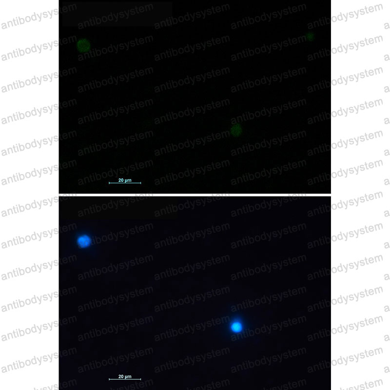 Валидация IF - AntibodySystem RHC91001