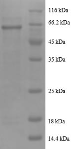 SDS-PAGE