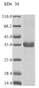 SDS-PAGE