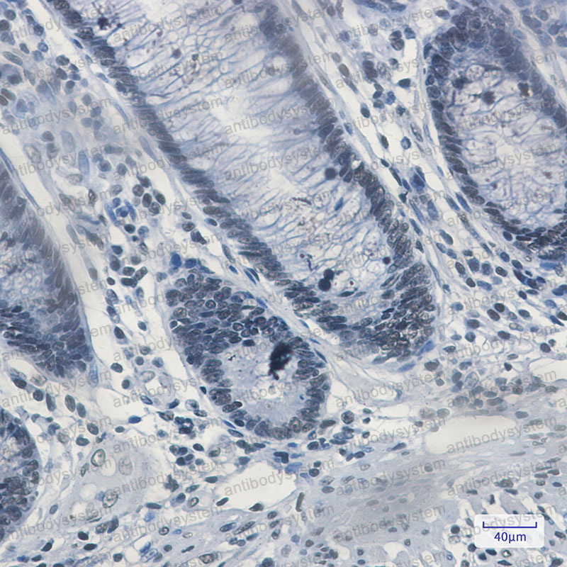 Валидация AntibodySystem RHE40401