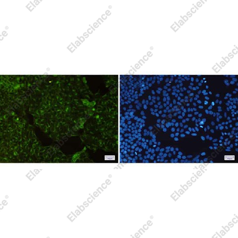 Иммунофлуоресценция, Transferrin Receptor, клетки HeLa