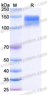 AHC21001, SDS-PAGE