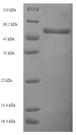 SDS-PAGE