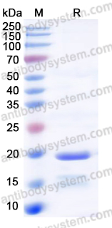YHF57002, SDS-PAGE