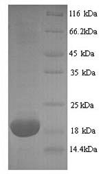 SDS-PAGE