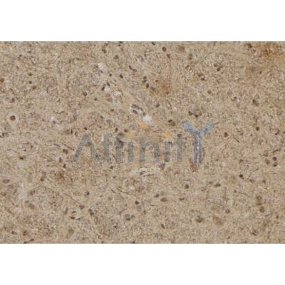 Валидация Affinity DF9804 - 22672