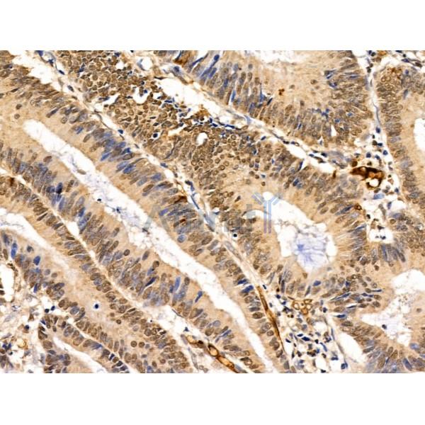 Валидация Affinity DF13699 - 9303