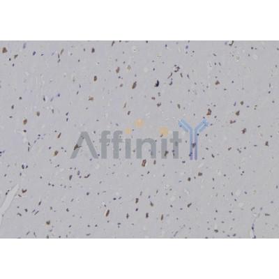 Валидация Affinity DF6943 - 18557