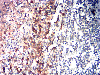 Валидация AntibodySystem RHF32702