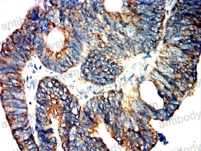 Валидация AntibodySystem RHJ64002 (3494)