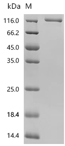SDS-PAGE