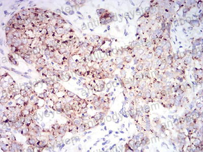 Валидация AntibodySystem RHN95501