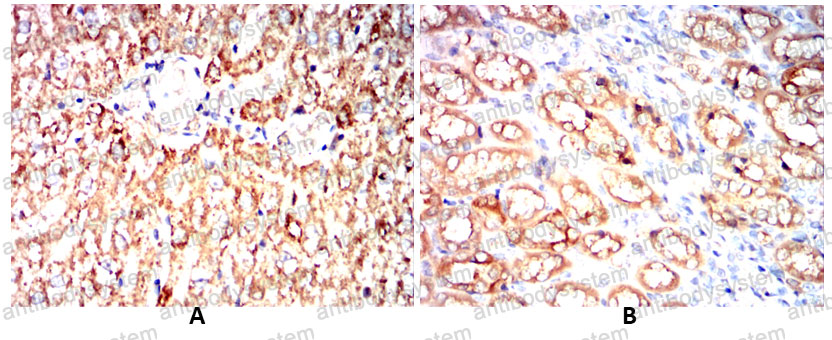 Валидация AntibodySystem RHC12802 (657)