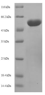 SDS-PAGE