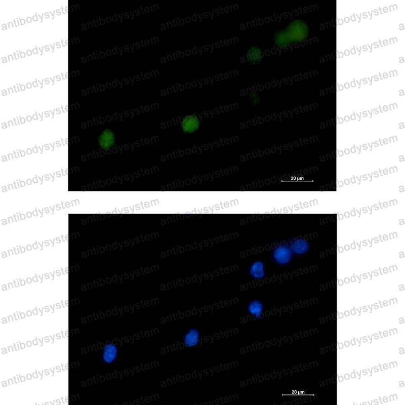 Валидация IF - AntibodySystem RHB02001