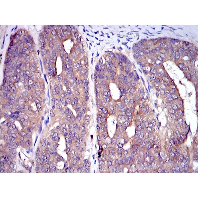 Валидация Affinity BF0151 - 5158