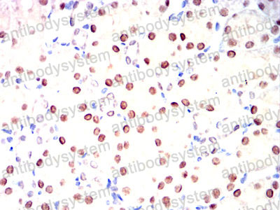 Валидация AntibodySystem RHE14901 (1995)