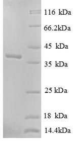 SDS-PAGE