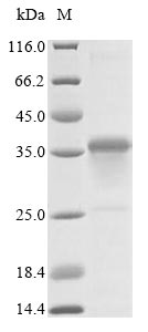 SDS-PAGE