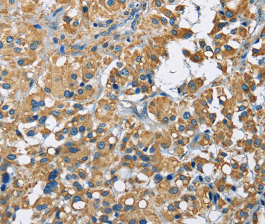 Валидация Elabscience E-AB-11012