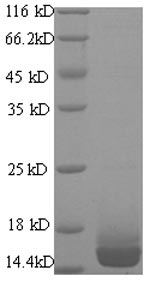 SDS-PAGE