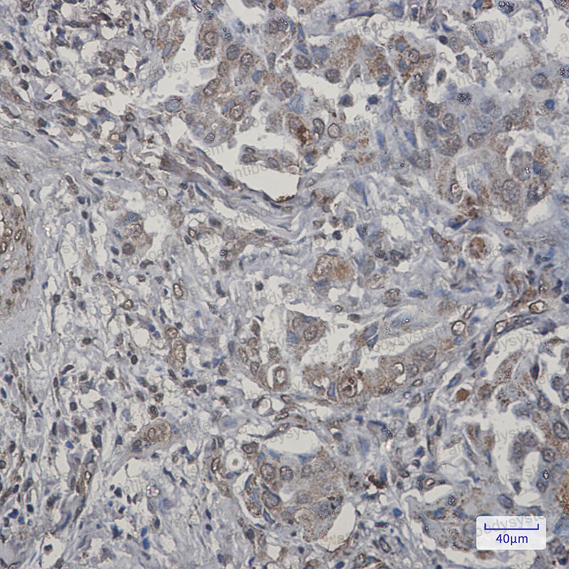 Валидация AntibodySystem RHD46401