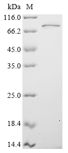 SDS-PAGE