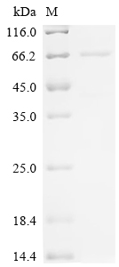SDS-PAGE