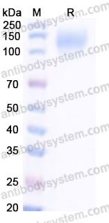 EWC21001, SDS-PAGE