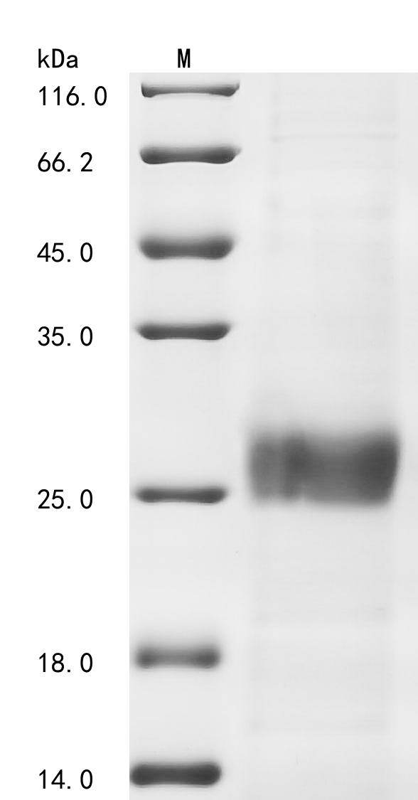 SDS-PAGE
