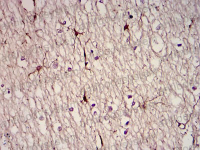 Валидация AntibodySystem RHD03106 (1283)