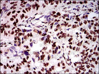 Валидация AntibodySystem RHN83202