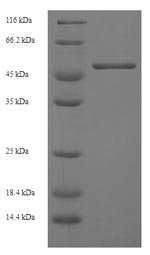 SDS-PAGE