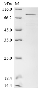 SDS-PAGE