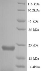 SDS-PAGE