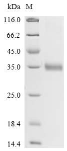 SDS-PAGE