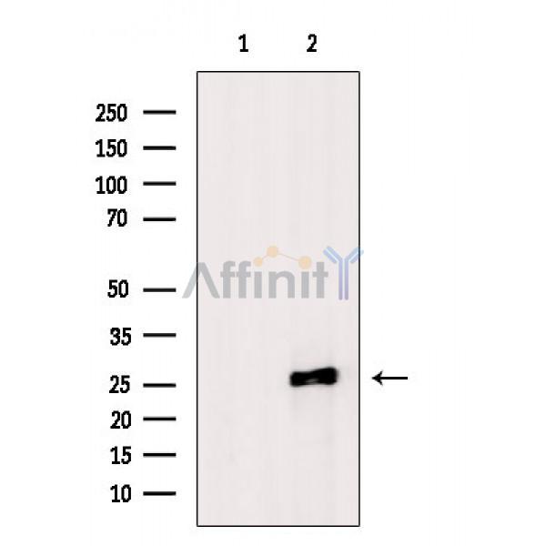 Валидация Affinity AF6588 - 3893