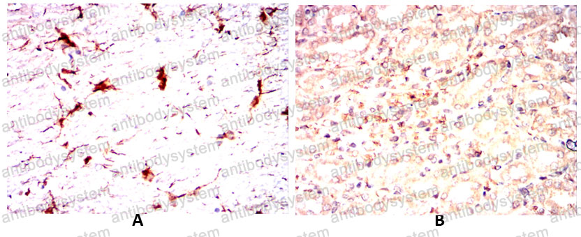 Валидация AntibodySystem RHA30301