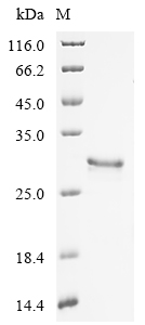 SDS-PAGE