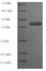 SDS-PAGE