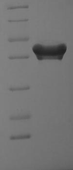 SDS-PAGE
