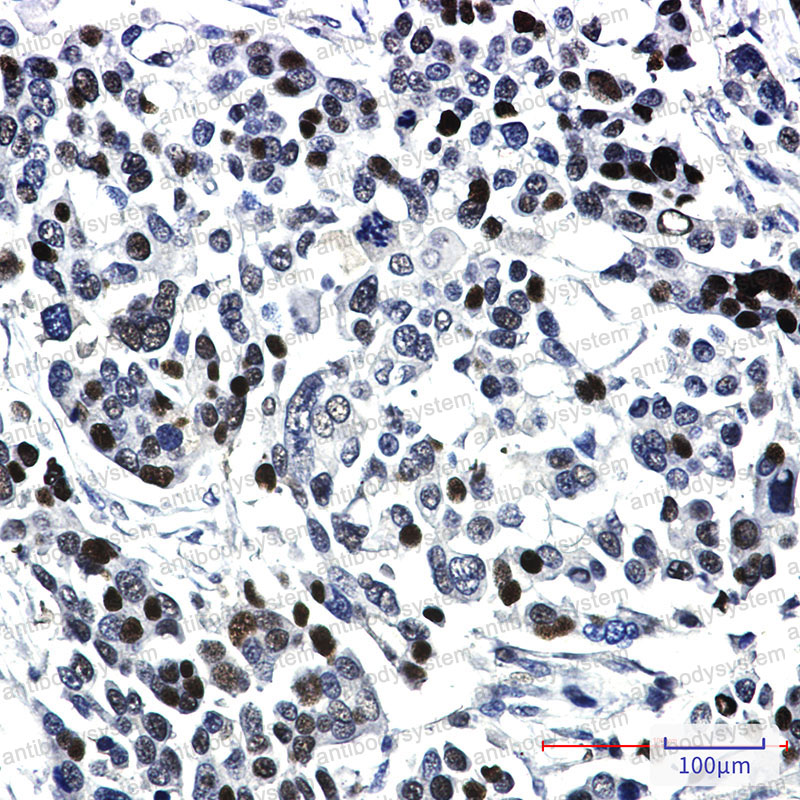 Валидация AntibodySystem RHH19901
