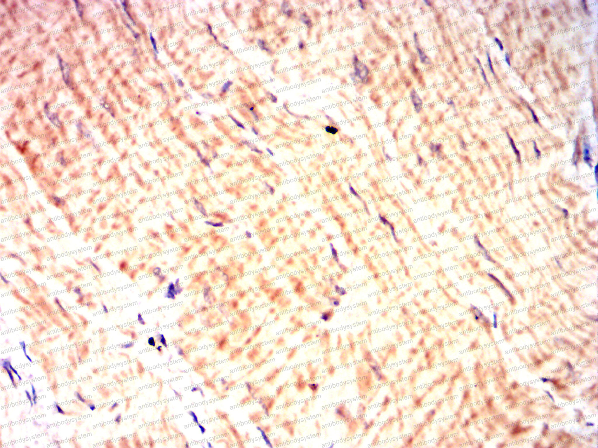 Валидация AntibodySystem RHH38602 (3292)