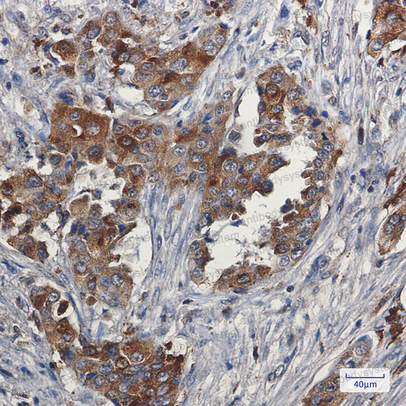 Валидация AntibodySystem RHF46402